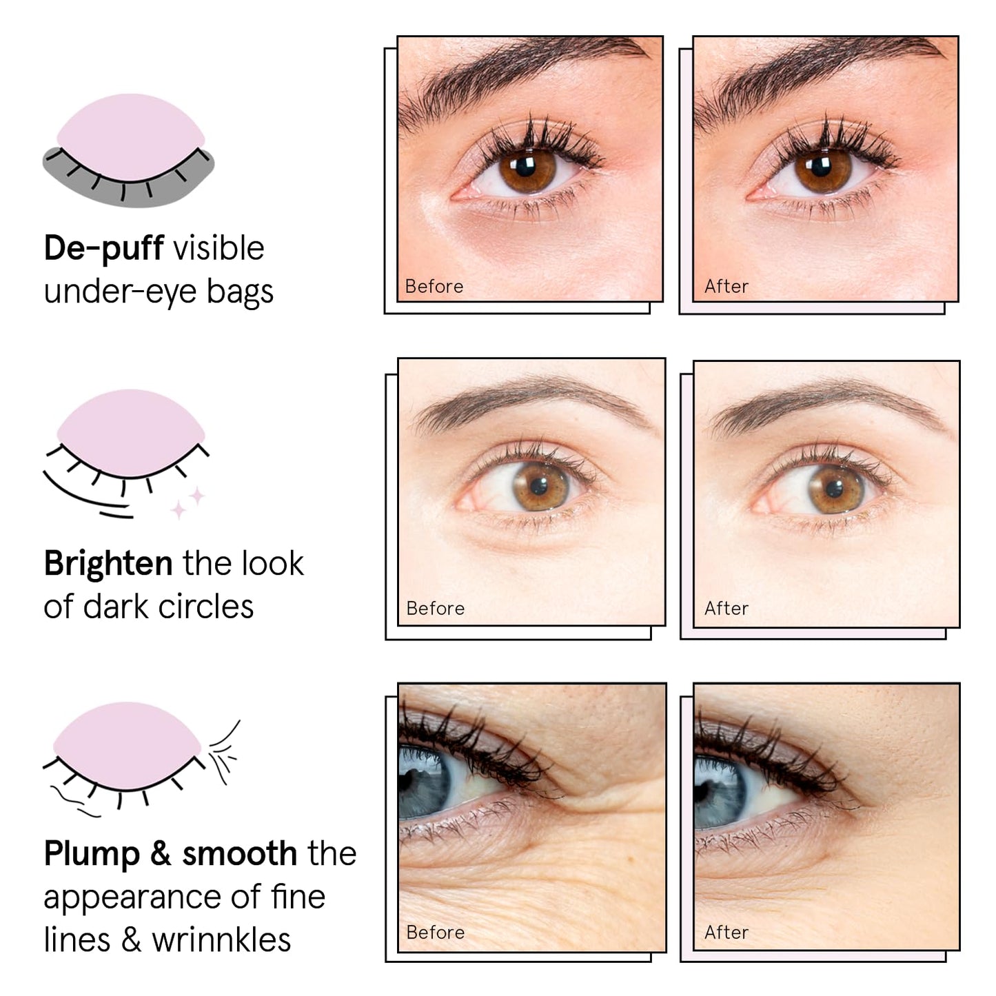grace & stella Under Eye Patches (12 pairs) Eye Masks for Dark Circles and Puffiness - Stocking Stuffers for Women, Christmas Gifts, Birthday Gifts, Bachelorette Party Favors, Bridesmaid Proposal Gift